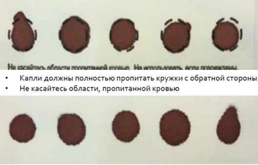 Приложение А3. Справочные материалы — Дефицит 3-гидрокси-3-метилглутарил-КоА лиазы