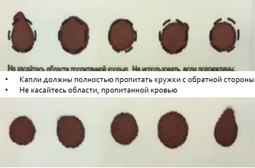 Приложение А3. Справочные материалы — Множественная недостаточность карбоксилаз (недостаточность биотинидазы и синтетазы голокарбоксилаз)